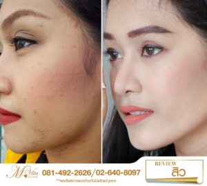 รีวิว1 คุณน้ำฝน