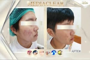 รีวิว3 คุณตุ้ย