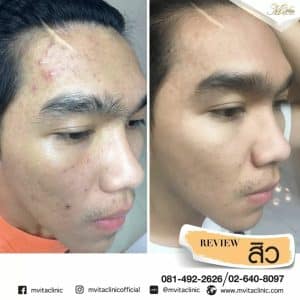 รีวิว4 คุณฟลุ้ค