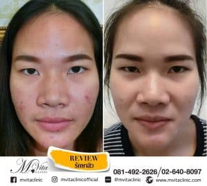 รีวิว5