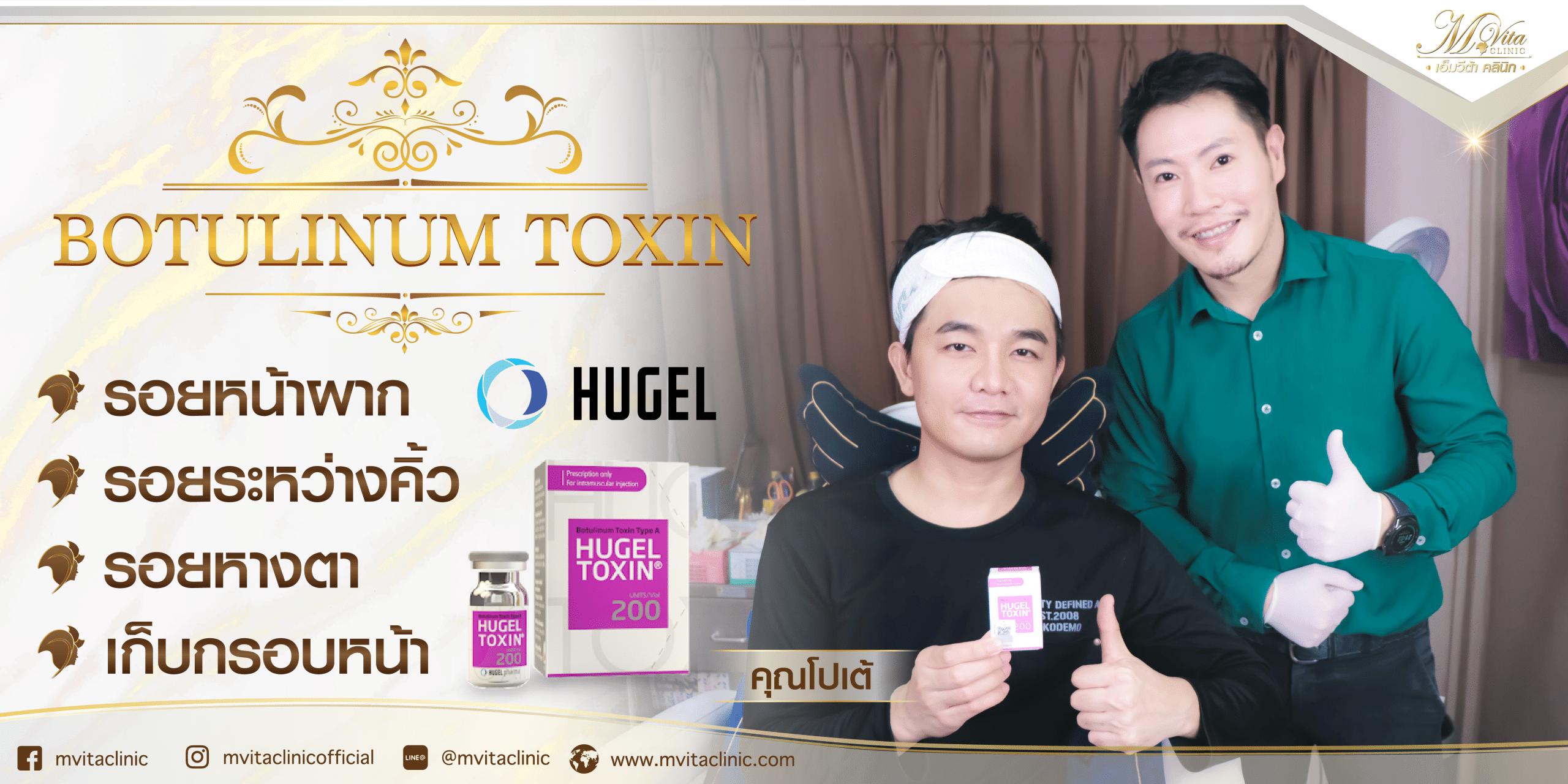 รีวิว โบท็อกซ์ Hugel botox toxin ผลลัพธ์การเปลี่ยนแปลง