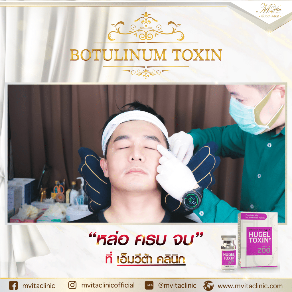 รีวิว โบท็อกซ์ Hugel botox toxin ผลลัพธ์การเปลี่ยนแปลง