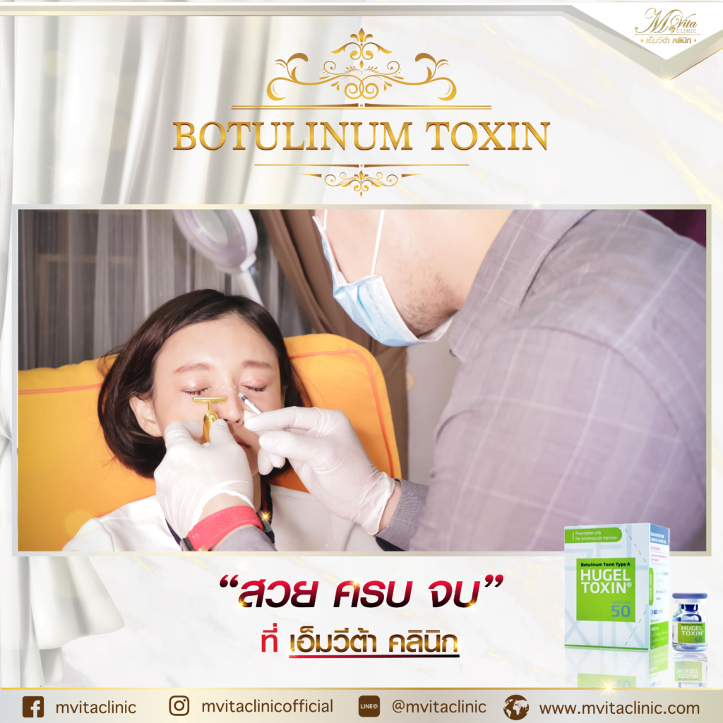 รีวิว โบท็อกซ์ Hugel botox toxin ผลลัพธ์การเปลี่ยนแปลง