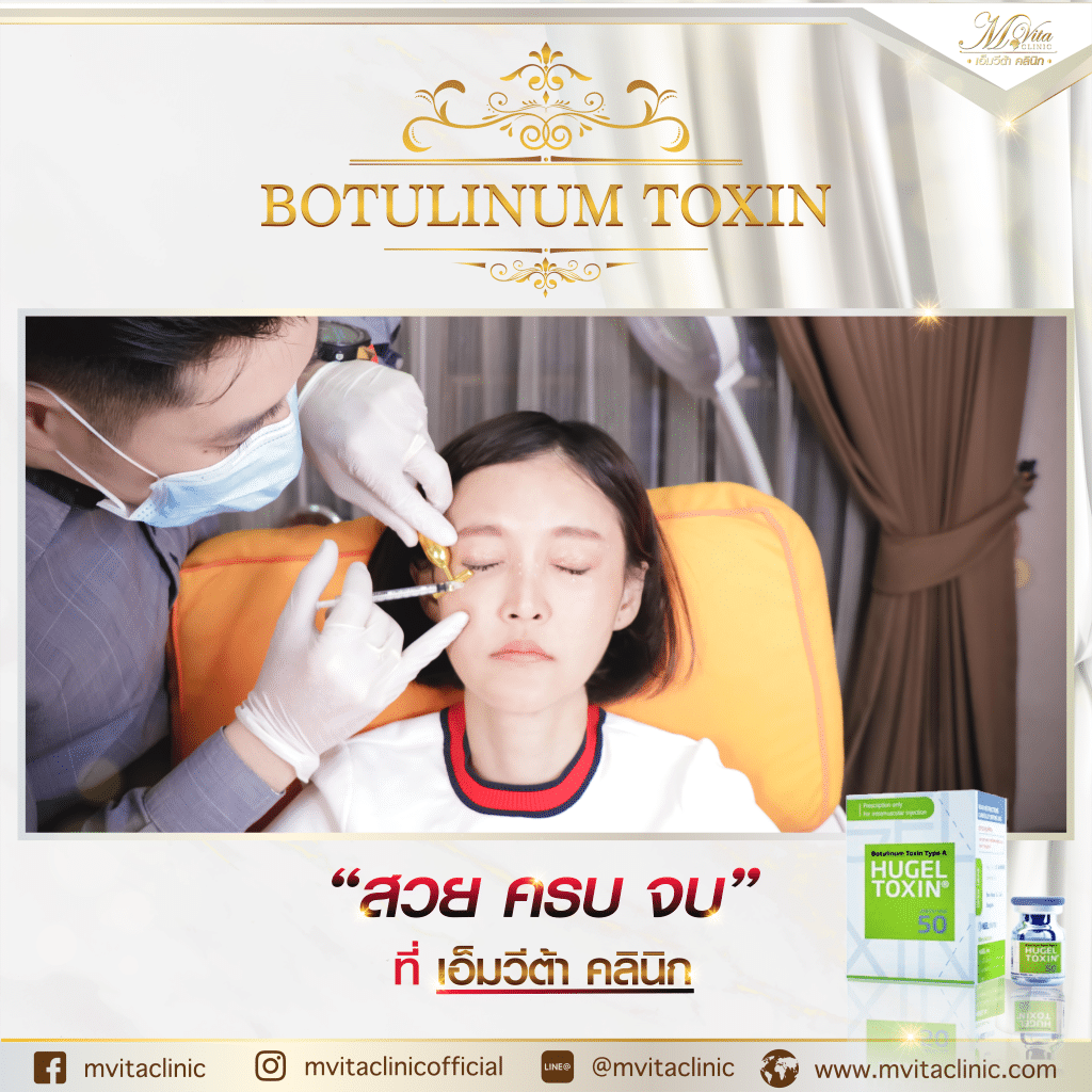 รีวิว โบท็อกซ์ Hugel botox toxin ผลลัพธ์การเปลี่ยนแปลง