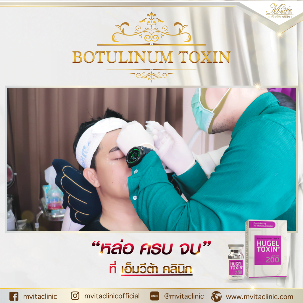 รีวิว โบท็อกซ์ Hugel botox toxin ผลลัพธ์การเปลี่ยนแปลง