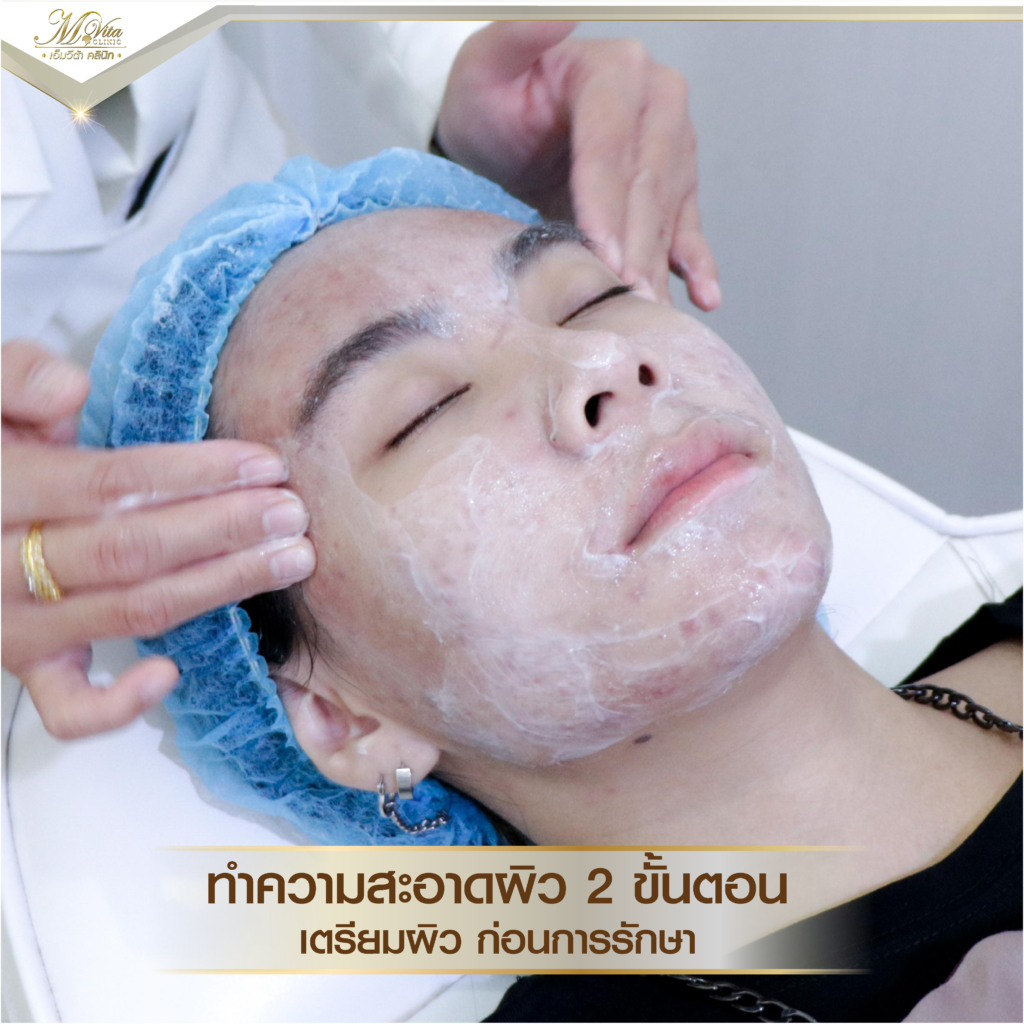 คลินิกรักษาสิว