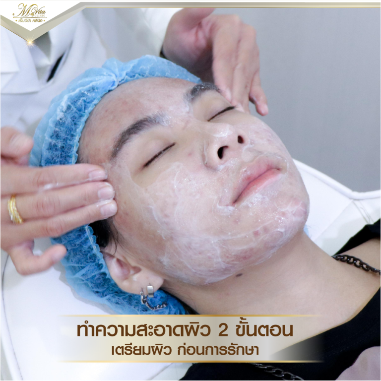 คลินิกรักษาสิว
