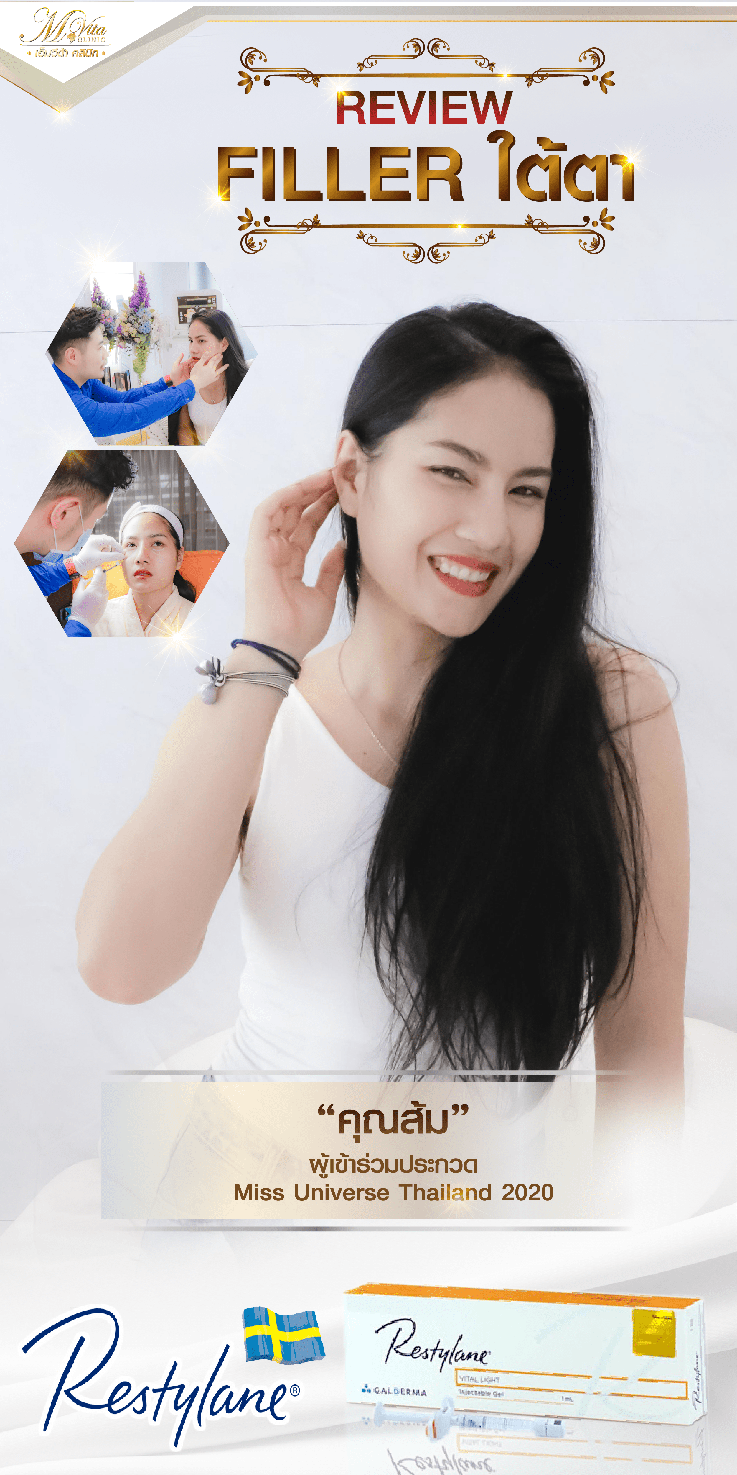 filler ใต้ตา