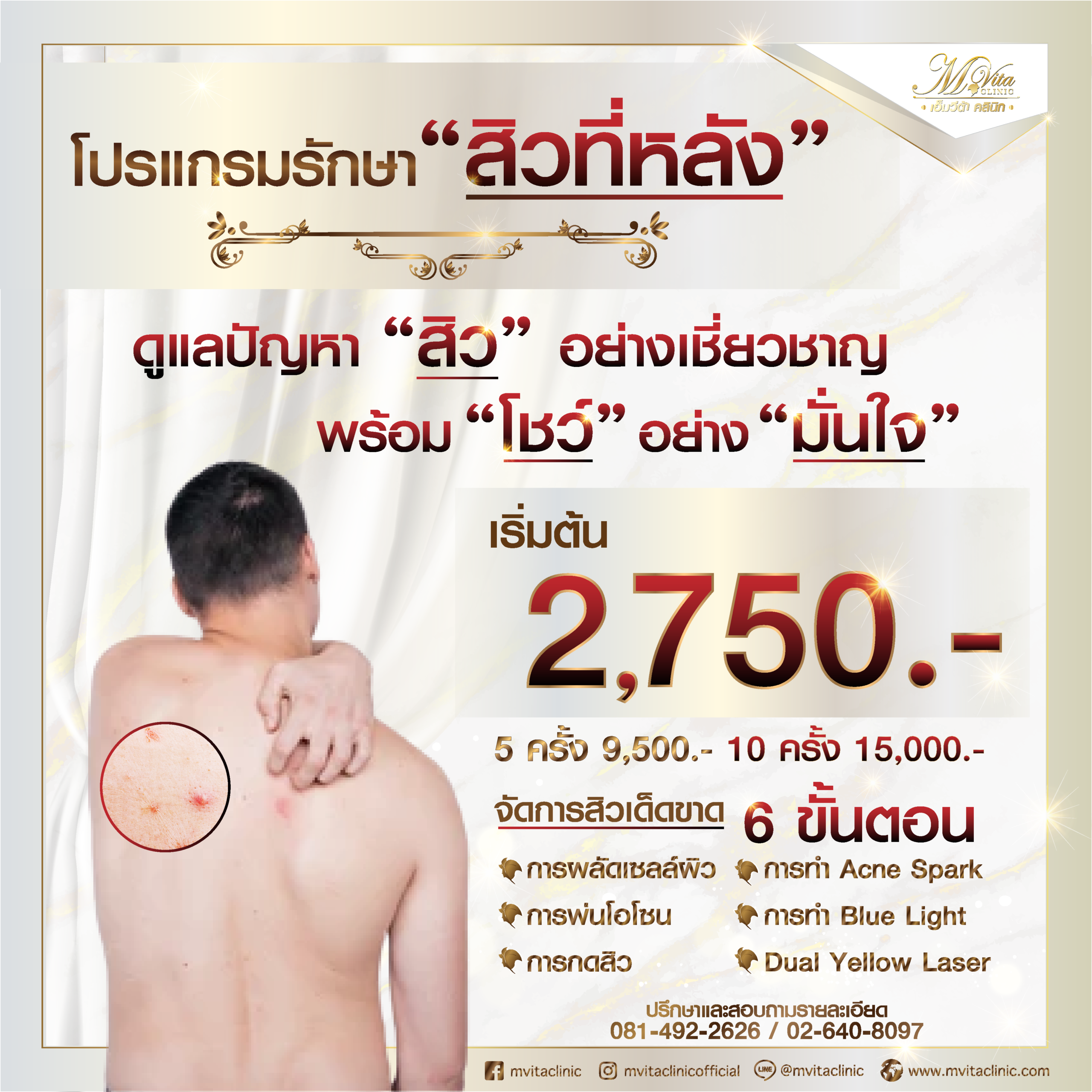 ราคา รักษาสิวที่หลังผู้ชาย-01