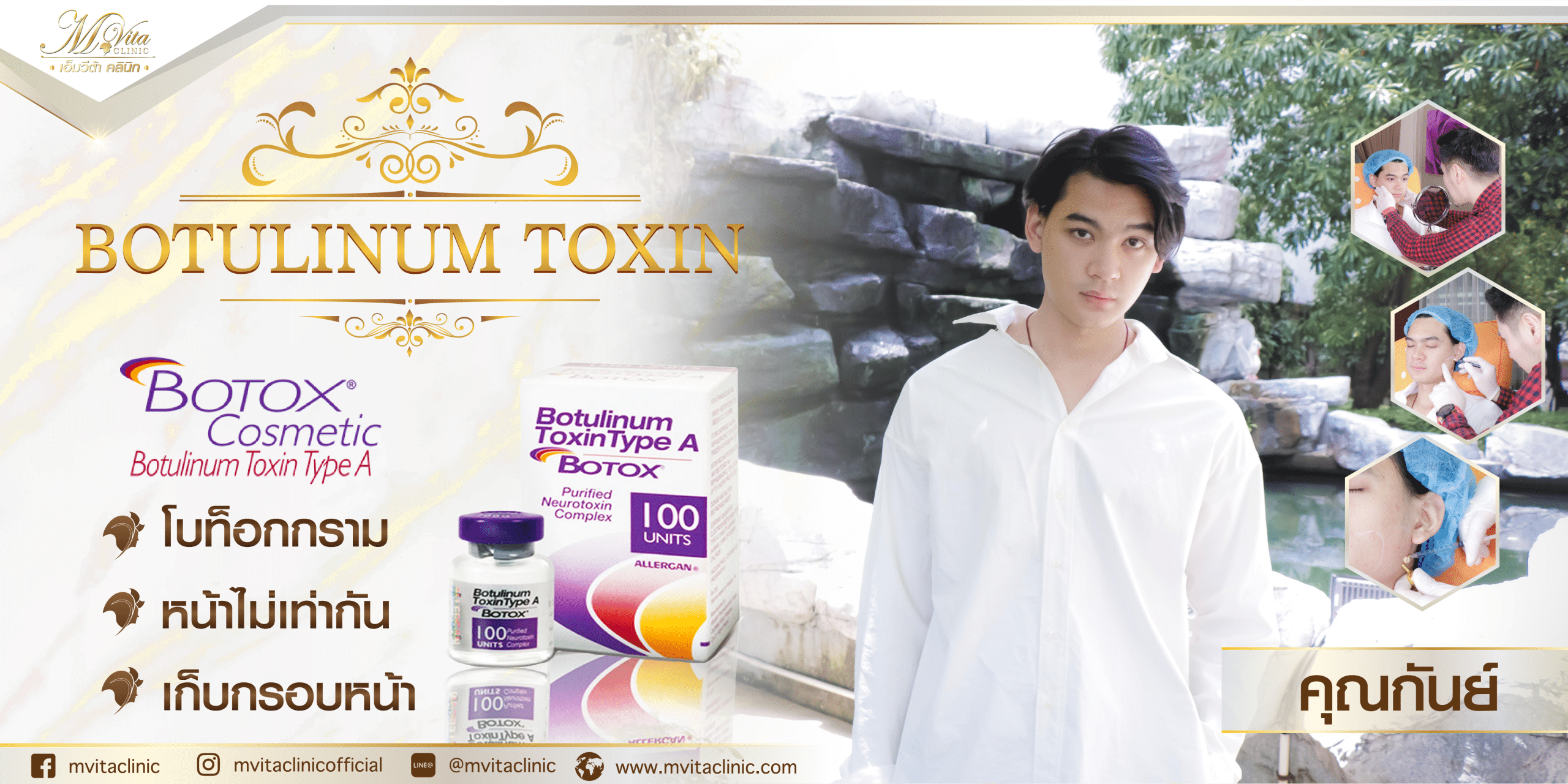 รีวิว Allergan Botox 1