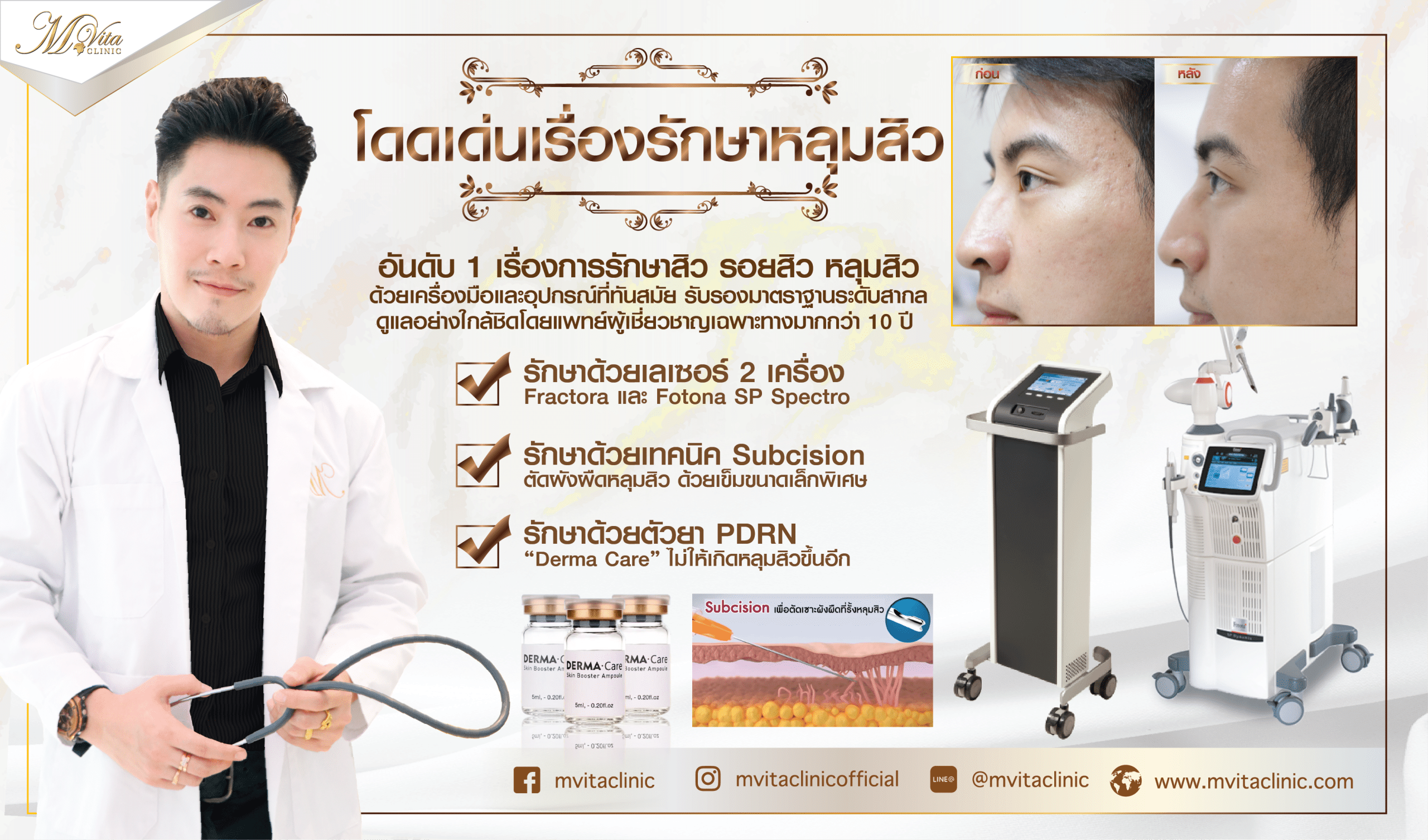 คอร์สรักษาสิว หลุมสิว