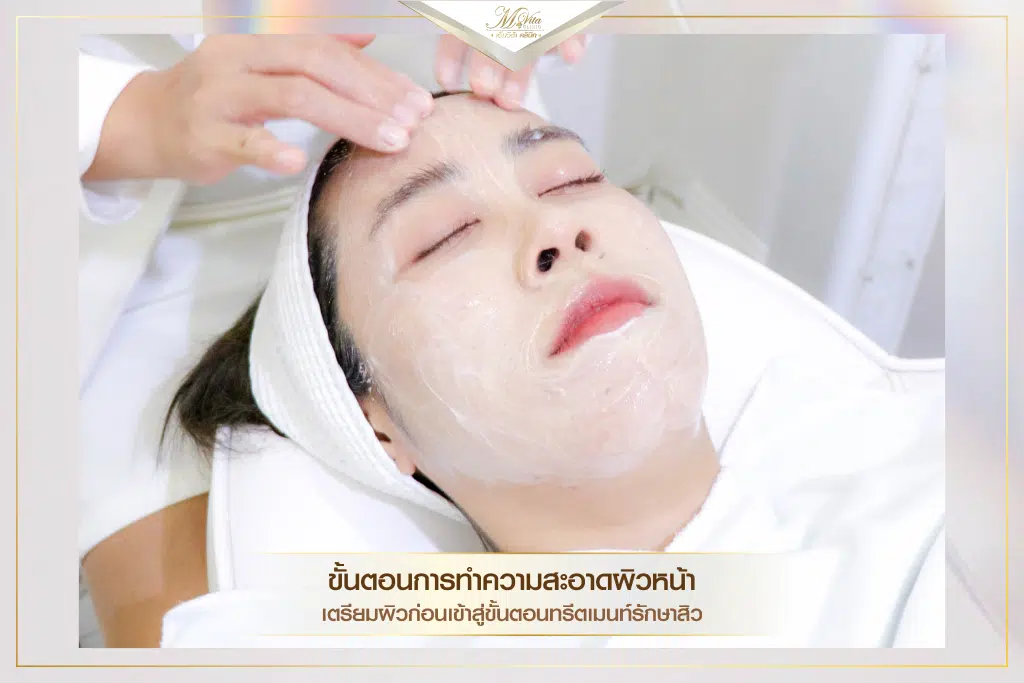 คอร์สรักษาสิว ราคา รีวิว คุณตอง-02