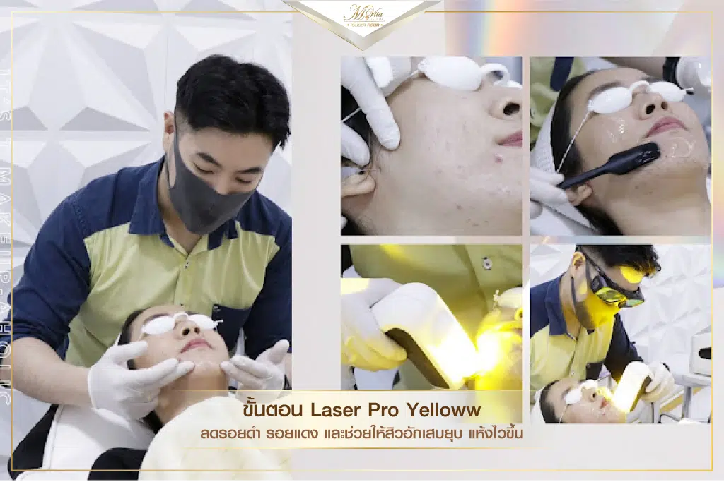 คอร์สรักษาสิว ราคา รีวิว คุณตอง-09