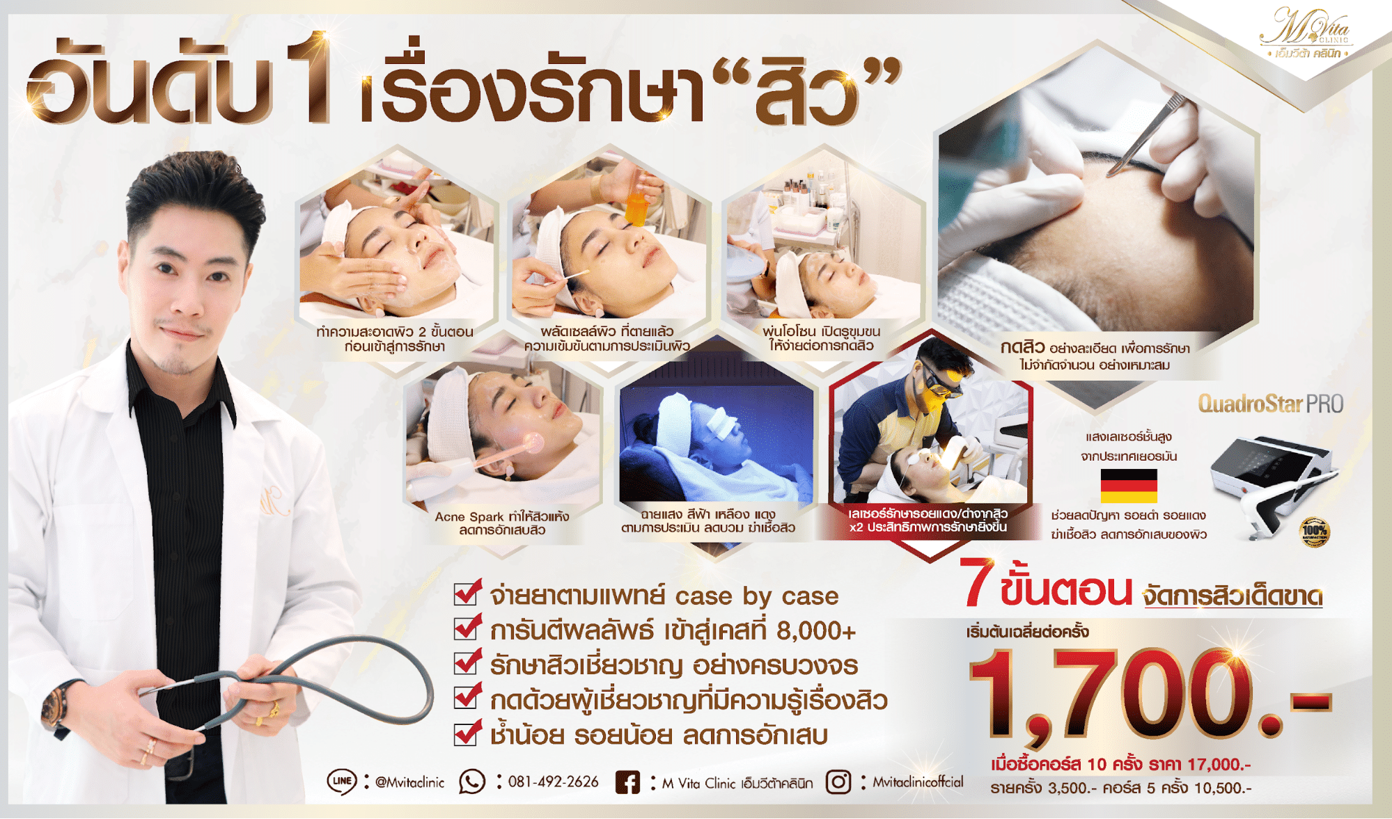 เลเซอร์รอยสิว ราคา