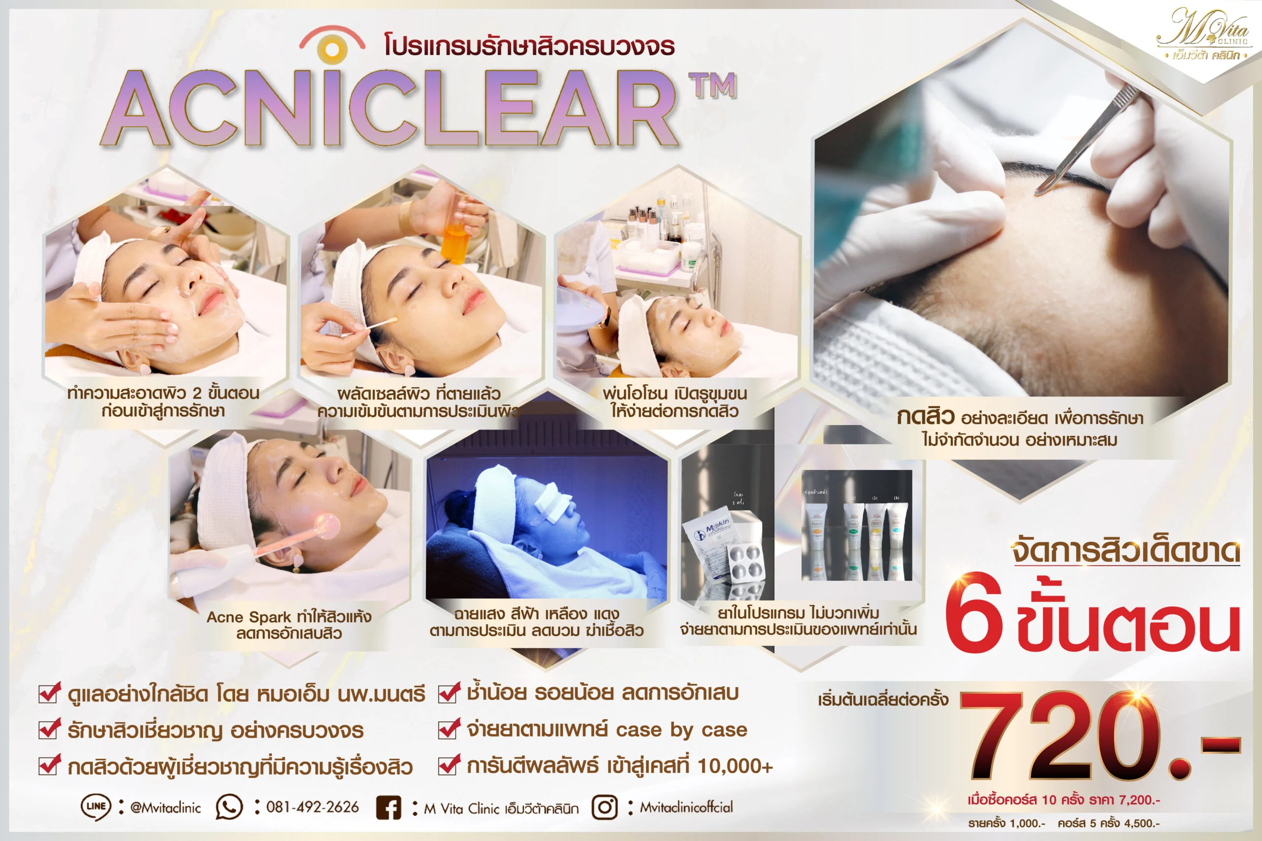 คอร์สรักษาสิว