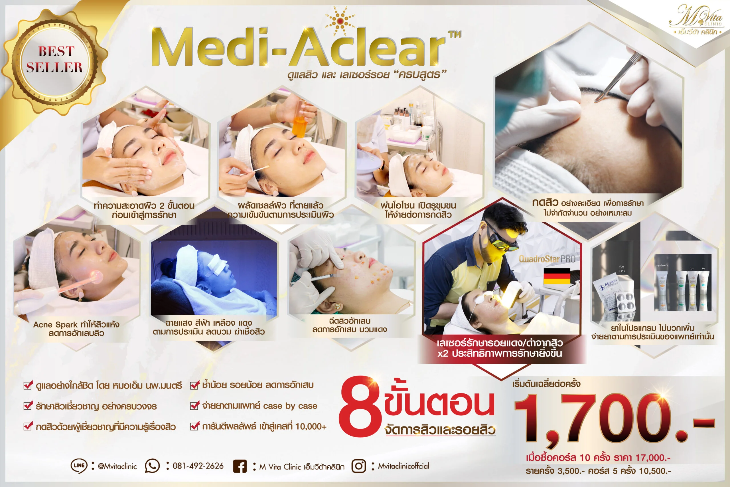 คอร์สรักษาสิว