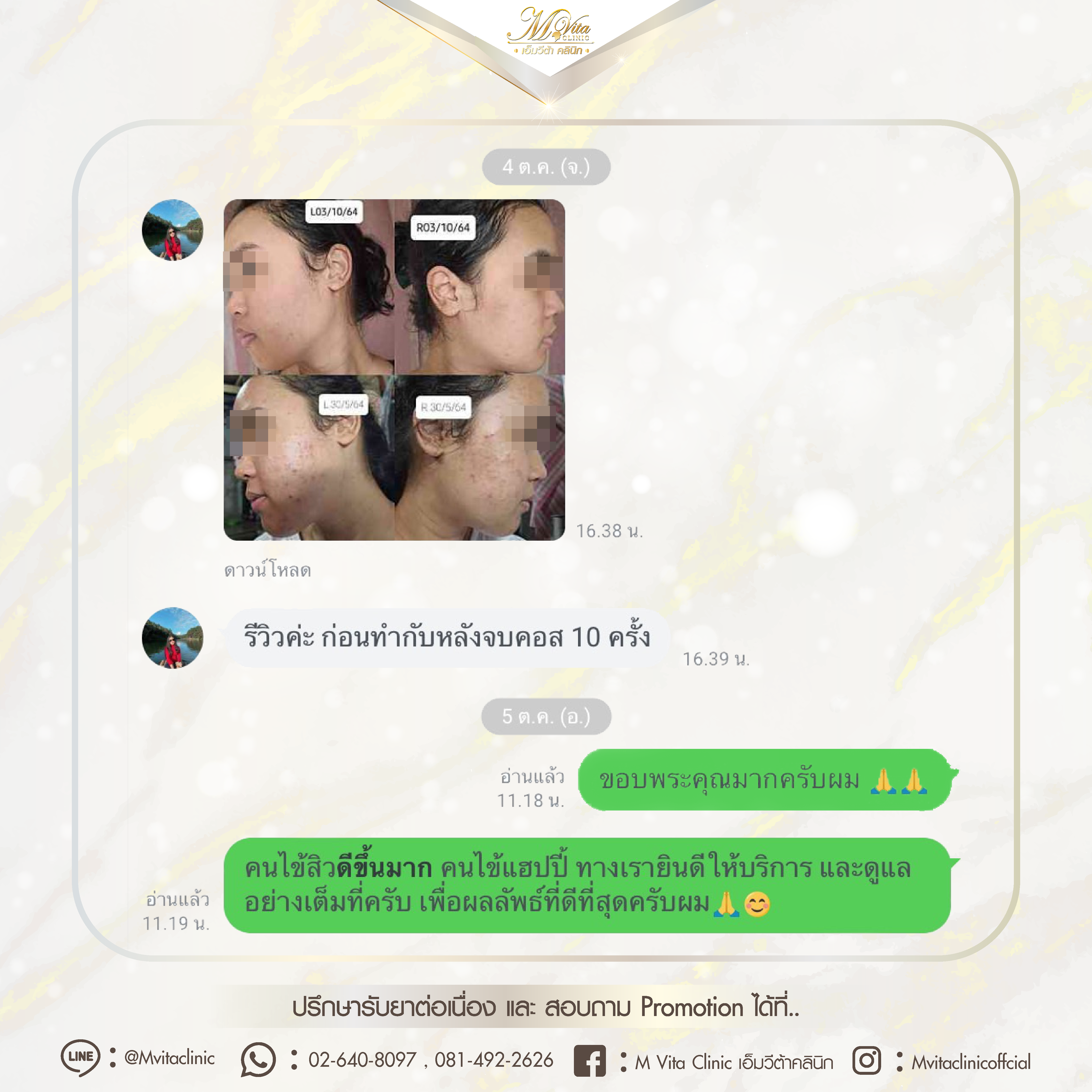 รีวิว เอ็มวีต้า คลินิก