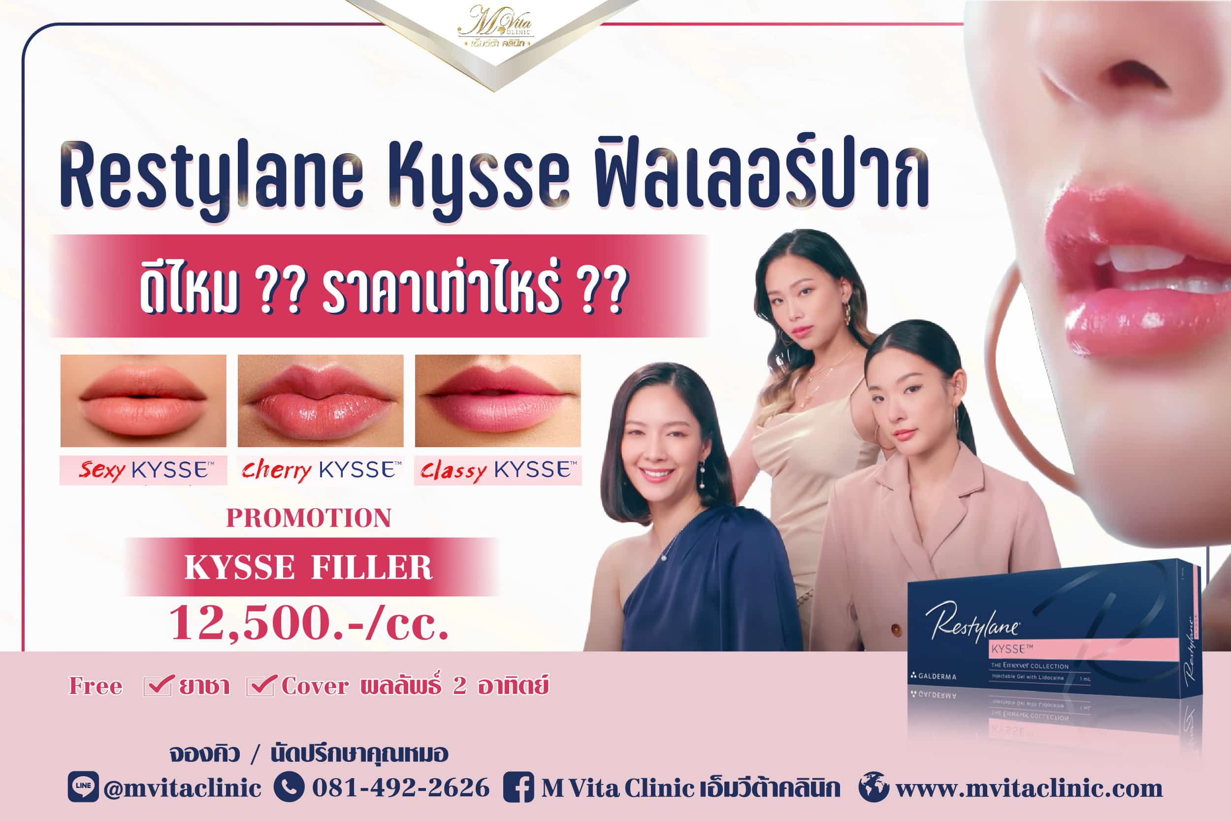 Restylane Kysse Filler ฟิลเลอร์ปาก ดีไหม ราคาเท่าไหร่