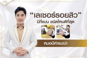 เลเซอร์รอยสิว