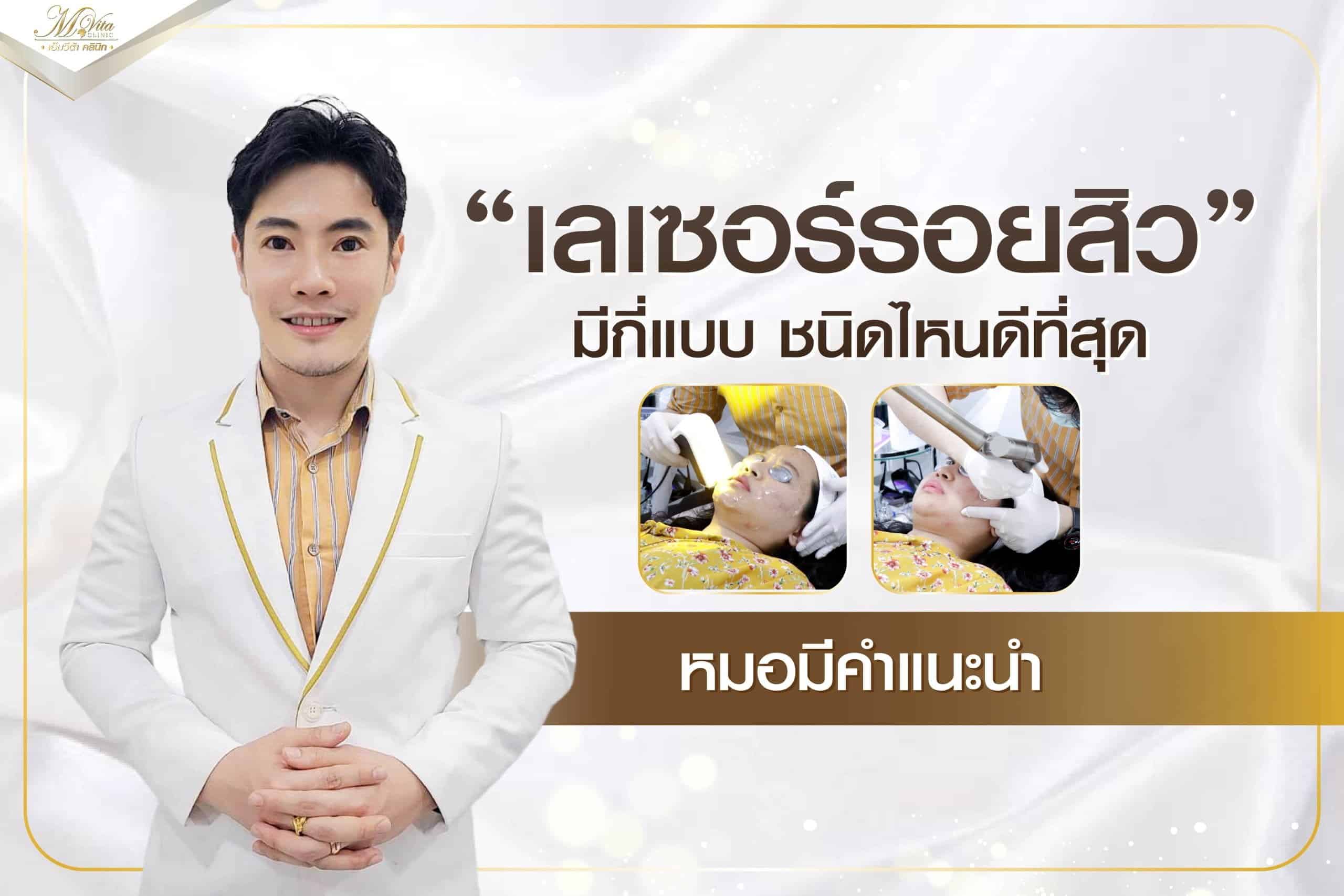 เลเซอร์รอยสิว มีกี่แบบ ชนิดไหนดีที่สุด หมอมีคำแนะนำ