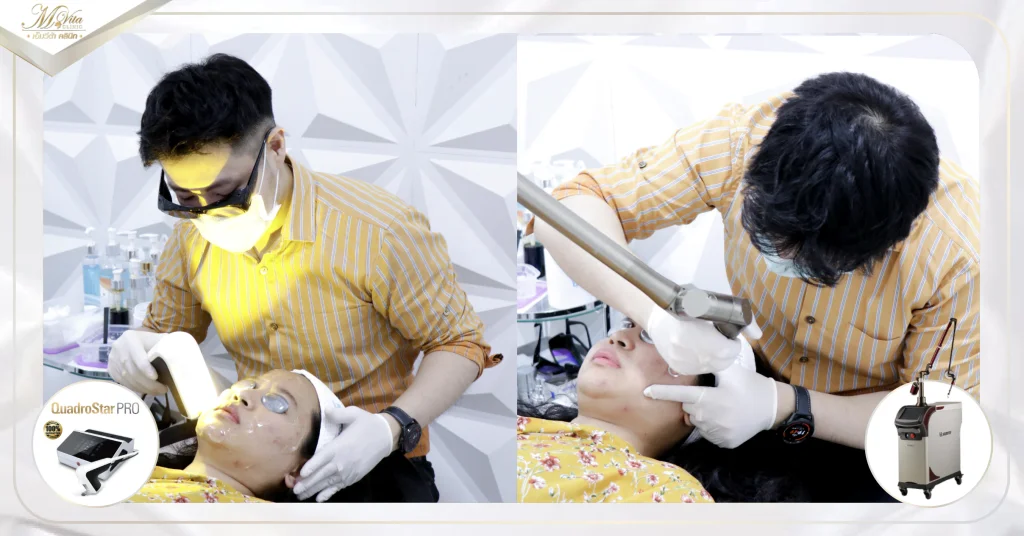 เลเซอร์รอยสิว รอยดำ