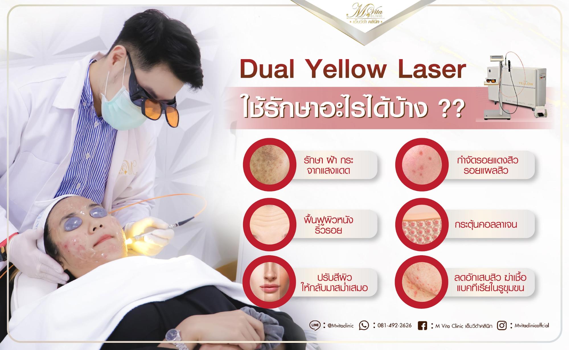 Dual Yellow Laser รักษา