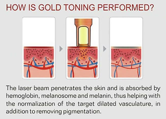 gold toning