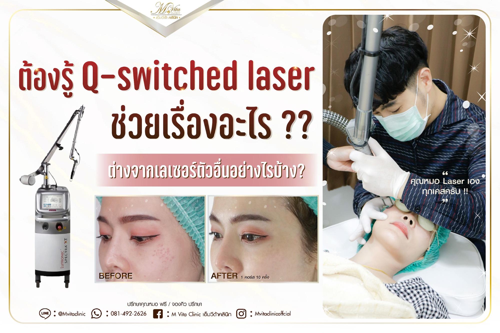 laser q switched nd yag