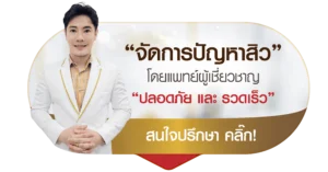 รักษาสิวกับแพทย์