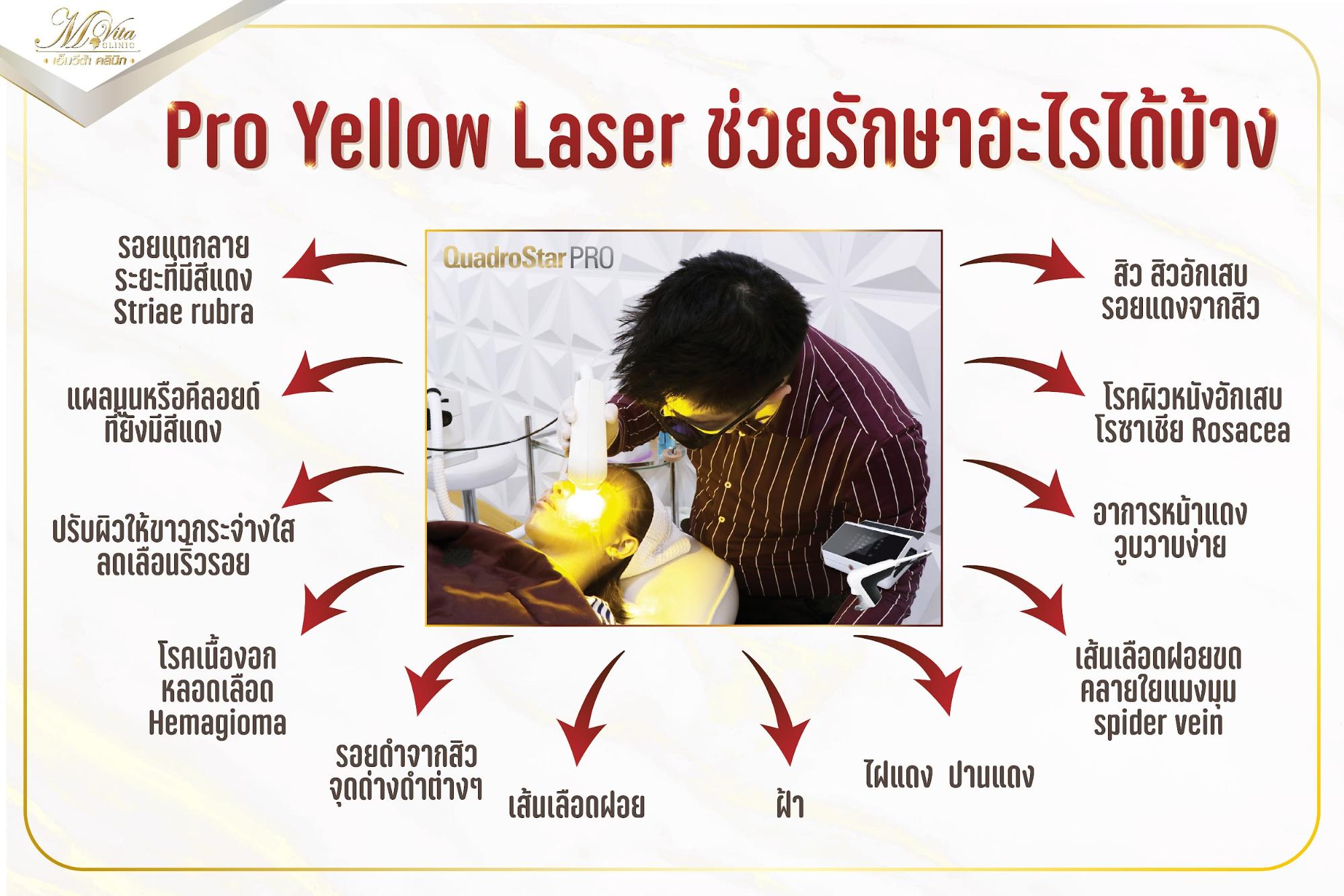 Pro Yellow Laser รักษา