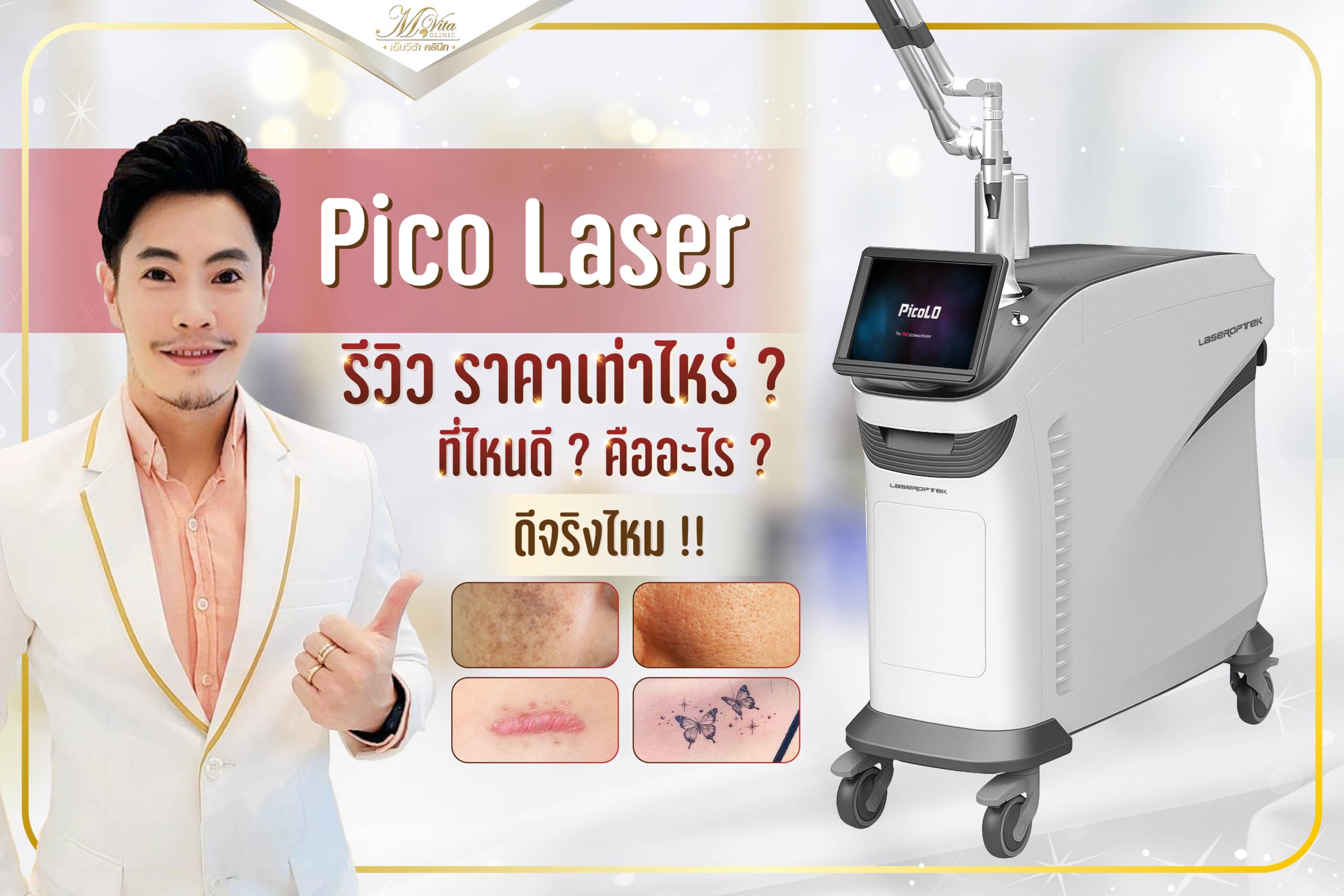 pico laser รีวิว ราคา