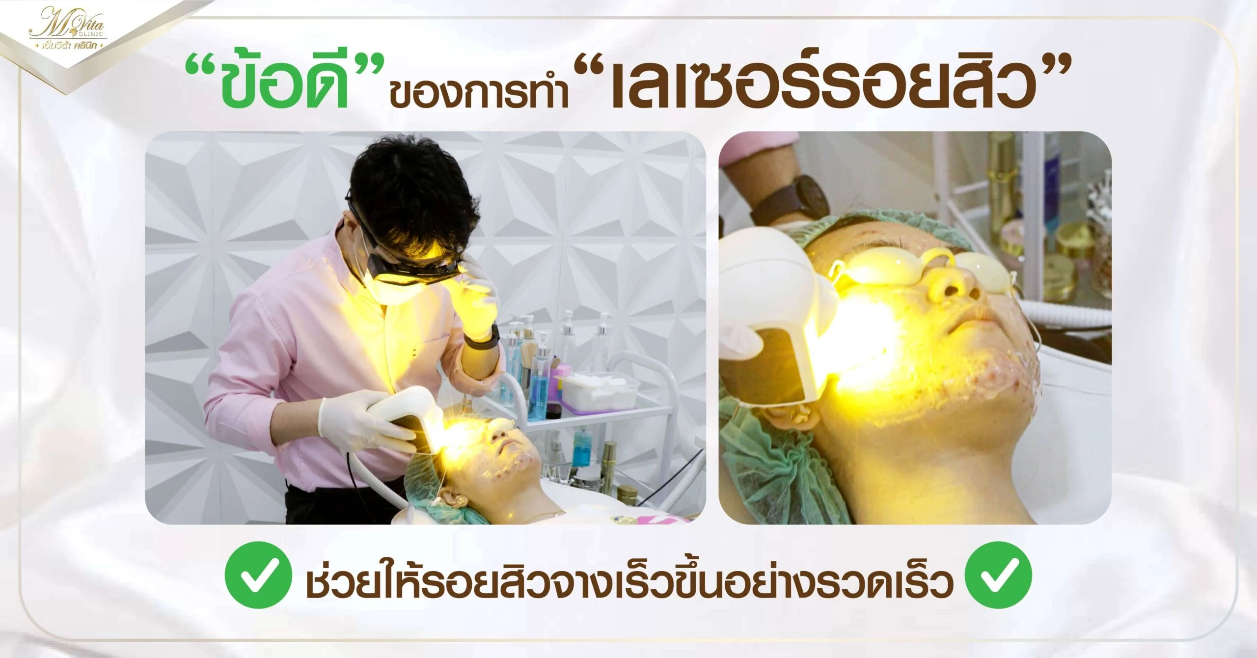 ข้อดีของการเลเซอร์รอยสิว