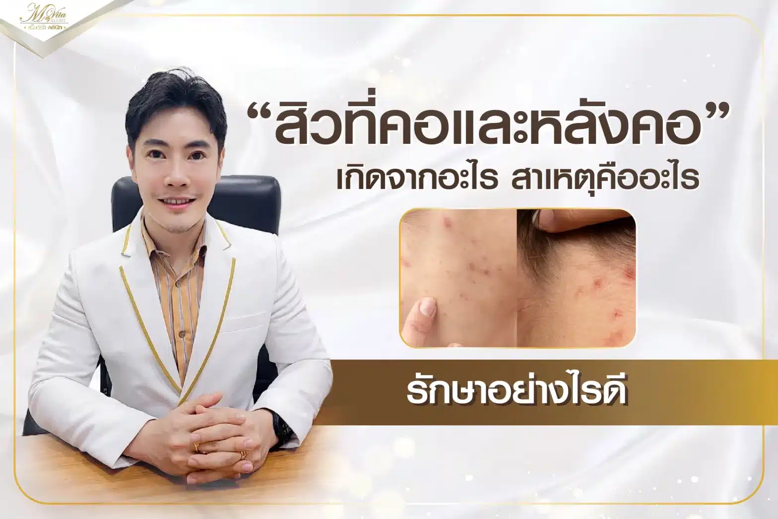 สิวที่คอ หลังคอ