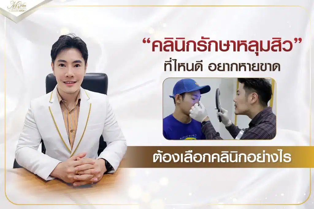 คลินิกรักษาหลุมสิวที่ไหนดี อยากหายขาดต้องเลือกคลินิกอย่างไร