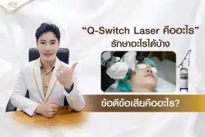Q-Switch Laser คืออะไร