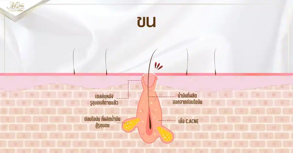 ขน