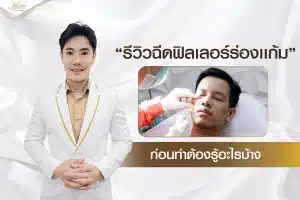 รีวิวฉีดฟิลเลอร์ร่องแก้ม