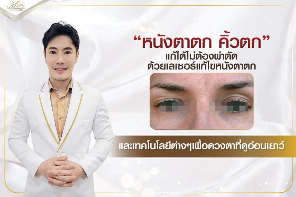 หนังตาตก-คิ้วตก