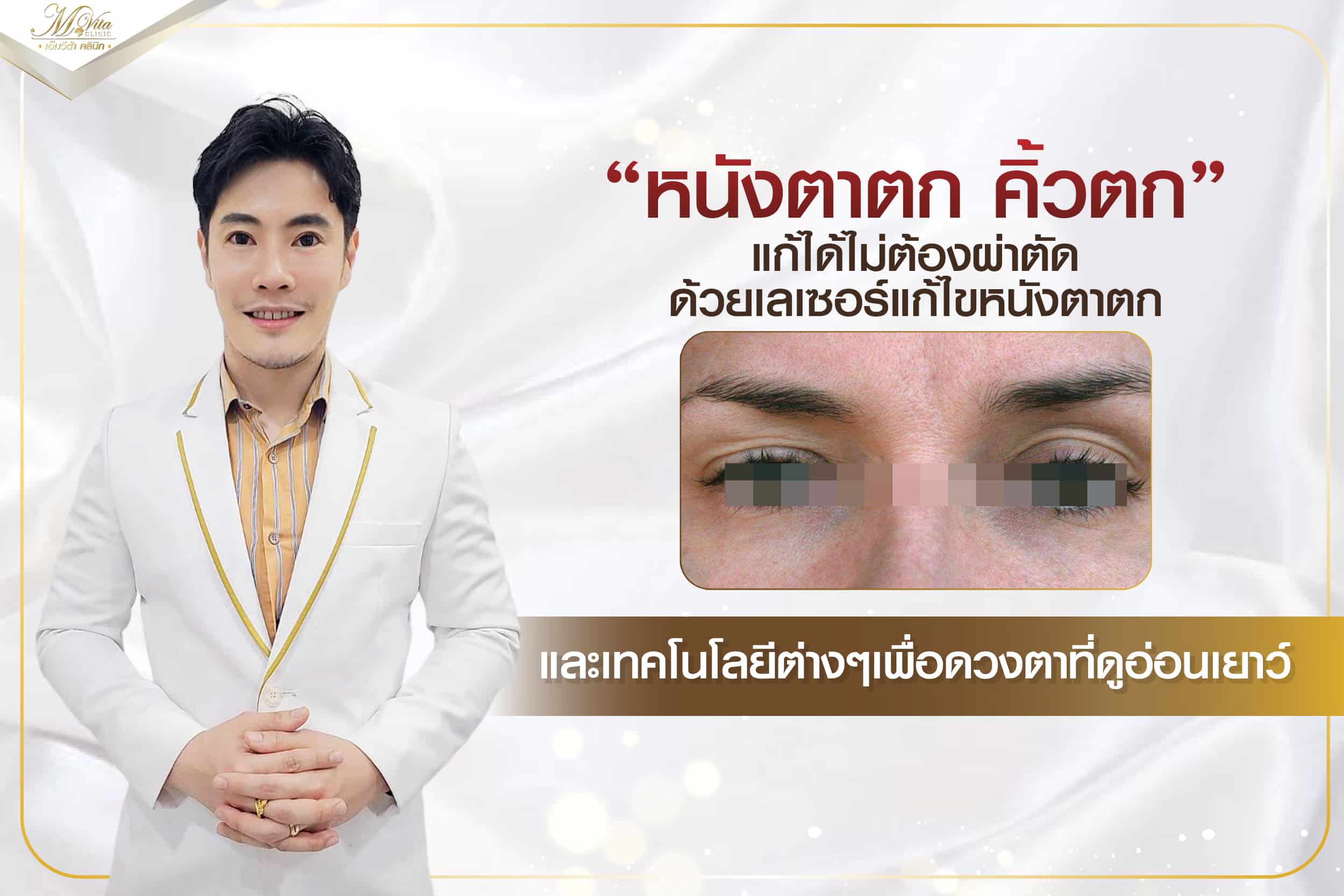 หนังตาตก-คิ้วตก