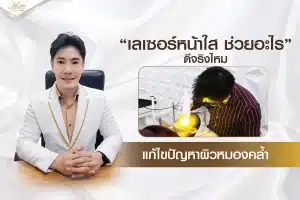 เลเซอร์หน้าใส