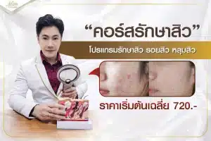 คอร์สรักษาสิว โปรแกรมรักษาสิว