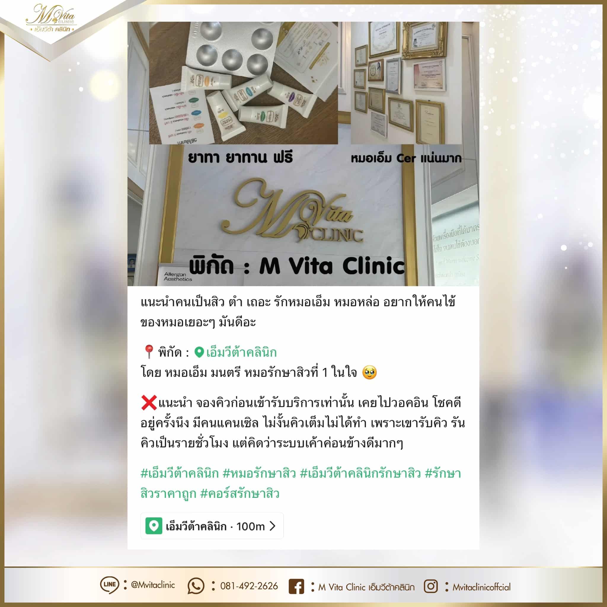 รีวิว รักษาสิว 4