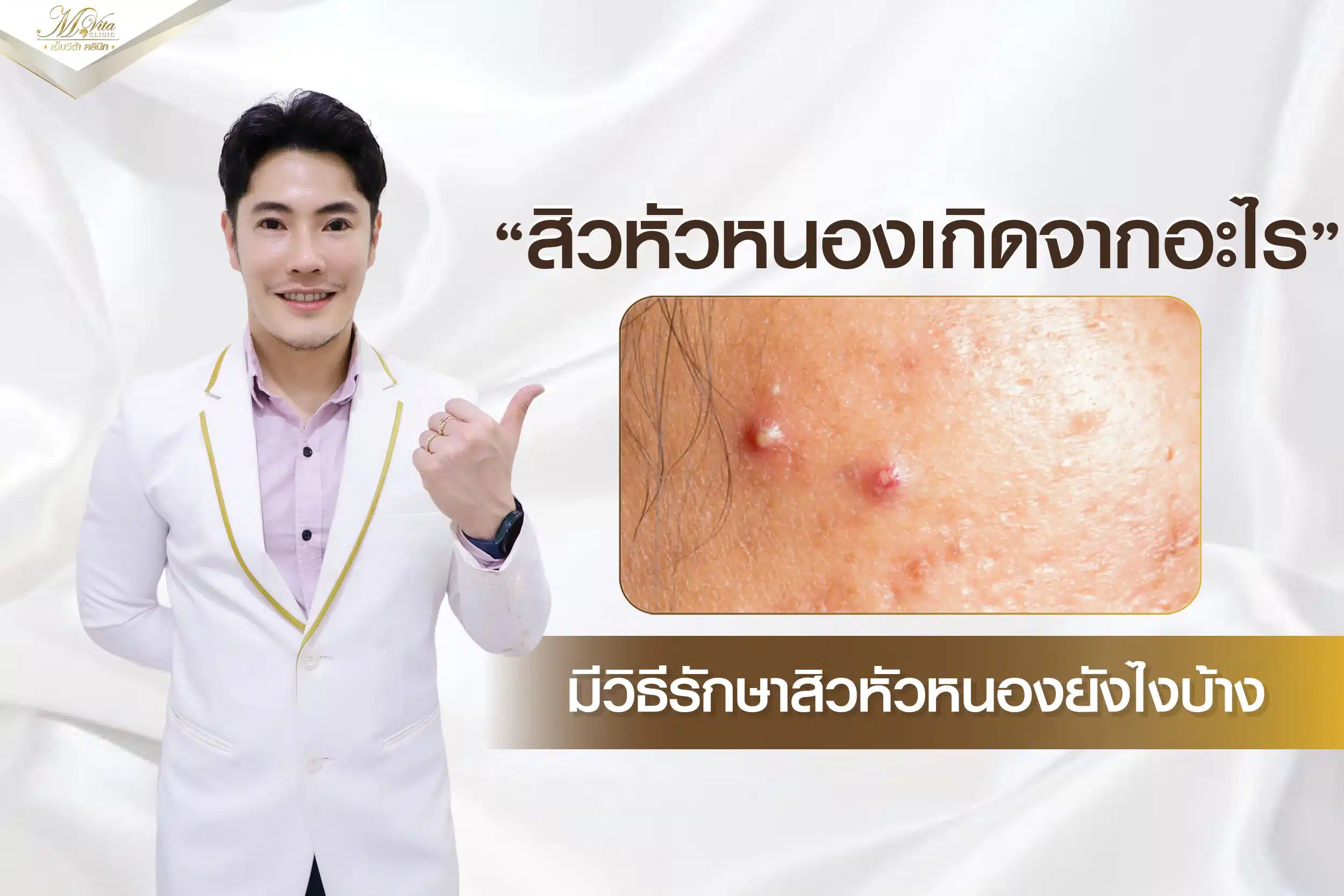 สิวหัวหนองเกิดจากอะไร