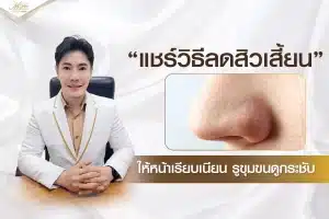 แชร์วิธีลดสิวเสี้ยน
