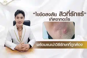 ไขข้อสงสัย สิวที่รักเเร้