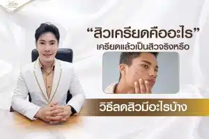 สิวเครียดคืออะไร