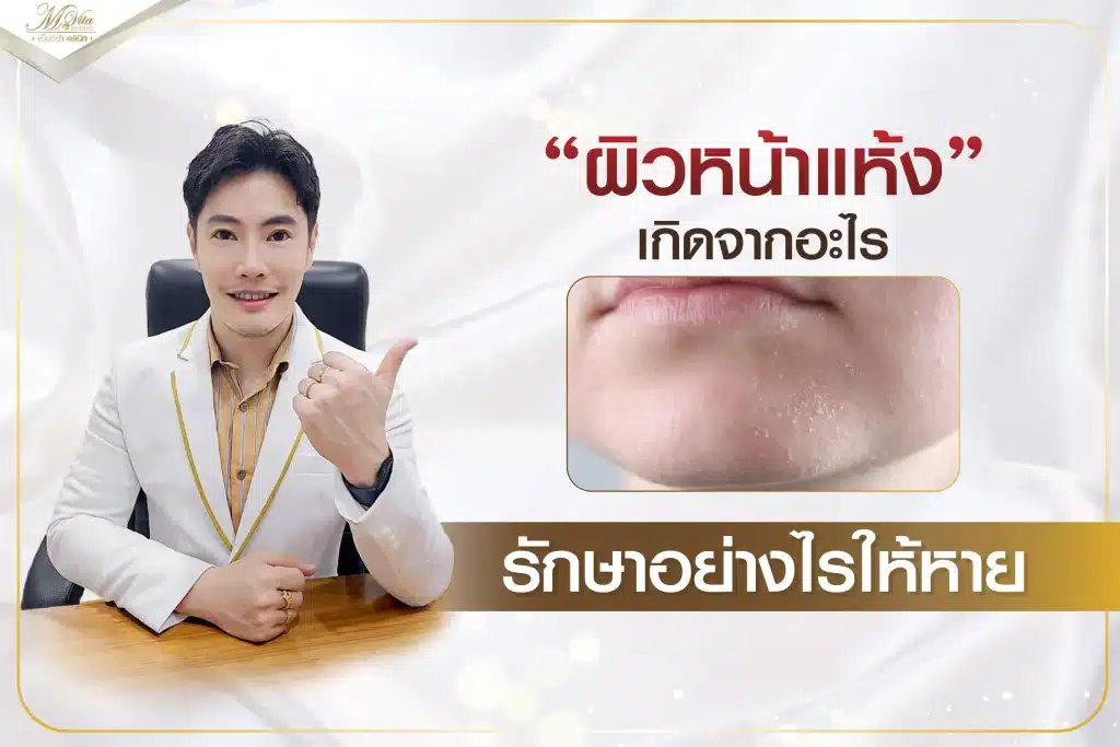 ผิวหน้าแห้ง เกิดจากอะไร รักษาอย่างไรให้หาย
