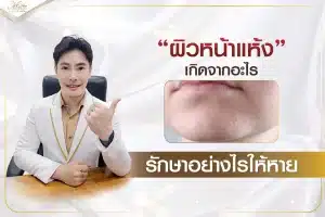 ผิวหน้าแห้ง เกิดจากอะไร รักษาอย่างไรให้หาย