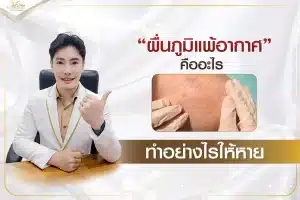 ผื่นภูมิแพ้อากาศ คืออะไร ทำอย่างไรให้หาย