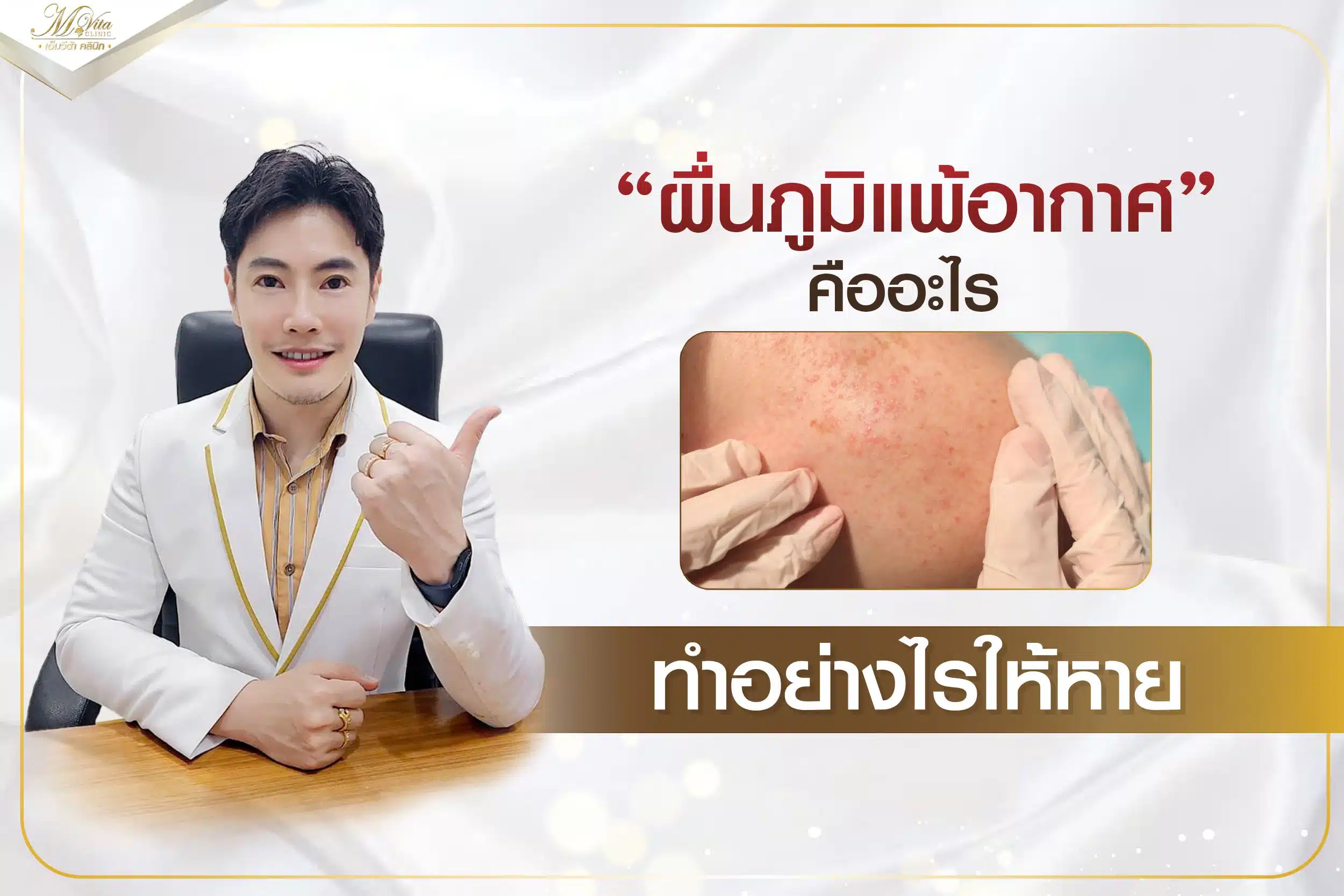 ผื่นภูมิแพ้อากาศ คืออะไร ทำอย่างไรให้หาย